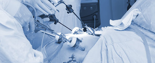 Advanced GI Surgery Delhi