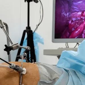 Laparoscopic Surgeon – Understanding Minimally Invasive Surgery and Its Benefits