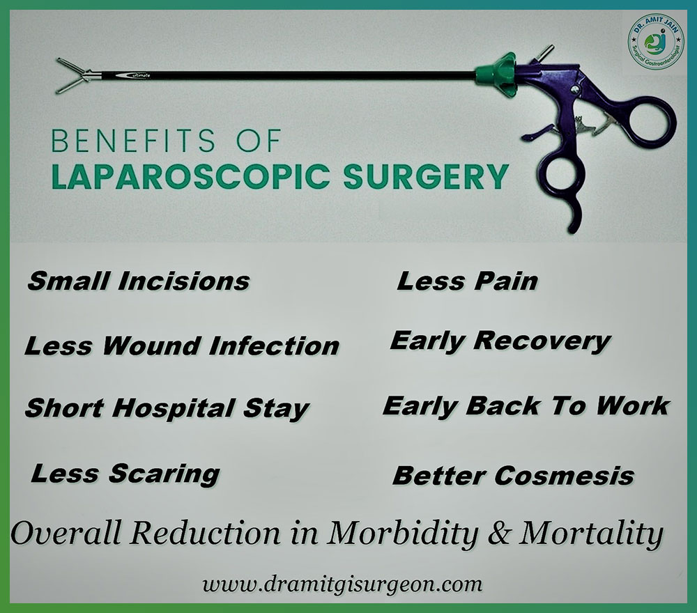 benefits of Laparoscopic
